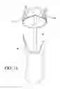 Fig. 08 - Dynamic exoskeletal orthosis