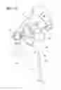 Fig. 09 - Dynamic exoskeletal orthosis