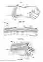 Fig. 10 - Gamers knuckle bracelet for hand exercises