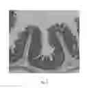 Fig. 07 - ORAL NOURISHING COMPOSITION AND METHODS THEREOF