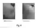 Fig. 09 - SEMI-SOLID TOPICAL COMPOSITION CONTAINING PIRFENIDONE AND MODIFIED DIALLYL DISULFIDE OXIDE (M-DDO) FOR ELIMINATING OR PREVENTING ACNE