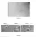 Fig. 03 - BONE MARROW DERIVED CD271 PRECURSOR CELLS FOR CARDIAC REPAIR
