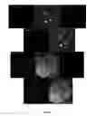 Fig. 05 - BONE MARROW DERIVED CD271 PRECURSOR CELLS FOR CARDIAC REPAIR
