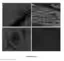 Fig. 07 - BONE MARROW DERIVED CD271 PRECURSOR CELLS FOR CARDIAC REPAIR