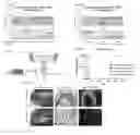 Fig. 07 - NON-GENOTOXIC CONDITIONING REGIMEN FOR STEM CELL TRANSPLANTATION