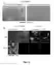 Fig. 09 - Targets of acinetobacter baumannii