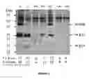 Fig. 02 - Methods and reagents for diagnosing Sjögren's Syndrome