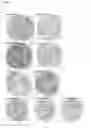 Fig. 17 - Antibodies binding AXL