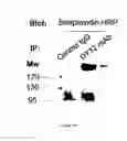 Fig. 02 - METHODS AND PHARMACEUTICAL COMPOSITIONS FOR ENHANCING NK CELL KILLING ACTIVITIES