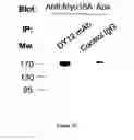 Fig. 05 - METHODS AND PHARMACEUTICAL COMPOSITIONS FOR ENHANCING NK CELL KILLING ACTIVITIES