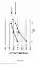 Fig. 10 - METHODS AND PHARMACEUTICAL COMPOSITIONS FOR ENHANCING NK CELL KILLING ACTIVITIES