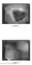 Fig. 02 - SOLID COMPOSITION FOR THE ORAL ADMINISTRATION OF DYES AND DIAGNOSTIC USE THEREOF