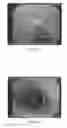 Fig. 03 - SOLID COMPOSITION FOR THE ORAL ADMINISTRATION OF DYES AND DIAGNOSTIC USE THEREOF