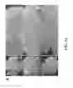 Fig. 09 - Methods for treating and diagnosing blinding eye diseases