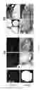 Fig. 07 - Methods and devices for the production of decellularised tissue scaffolds