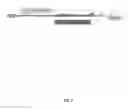 Fig. 08 - Methods and compositions for blood vessel tissue repair and engineering