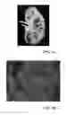 Fig. 06 - Vascular cast-based scaffolds and methods of making the same