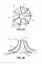Fig. 03 - Flexible Protection Device For Circulatory Support Device And Related Systems And Methods