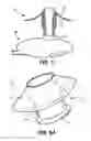 Fig. 05 - Flexible Protection Device For Circulatory Support Device And Related Systems And Methods