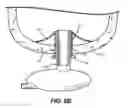 Fig. 06 - Flexible Protection Device For Circulatory Support Device And Related Systems And Methods