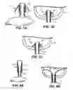 Fig. 07 - Flexible Protection Device For Circulatory Support Device And Related Systems And Methods