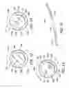 Fig. 05 - Ambulatory infusion devices and filter assemblies for use with same