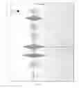 Fig. 12 - Detection of an infusion anomaly