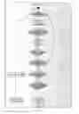 Fig. 13 - Detection of an infusion anomaly