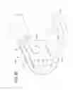 Fig. 07 - Bridle delivery system, method, and apparatus for securing nasal tubes