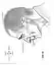 Fig. 09 - Headgear with covered edge
