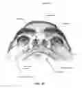 Fig. 10 - Headgear with covered edge