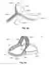 Fig. 23 - Headgear with covered edge
