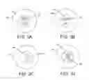Fig. 07 - IDENTIFICATION SYSTEM FOR INJECTABLE ACCESS PORTS