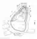 Fig. 02 - Delivery devices and methods for leadless cardiac devices
