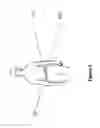 Fig. 07 - Non-invasive device and method for treating gastro esophageal reflux disease (GERD) and the digestive system