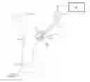 Fig. 01 - Enhancing left ventricular relaxation through neuromodulation