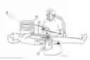 Fig. 01 - EXTERNAL DEFIBRILLATOR WITH POWER AND BATTERY SHARING CAPABILITIES WITH A POD