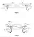 Fig. 09 - Gamers multi-digit device for hand exercises