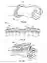 Fig. 10 - Gamers multi-digit device for hand exercises