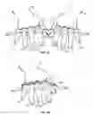 Fig. 11 - Gamers multi-digit device for hand exercises