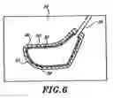 Fig. 08 - Golf club head