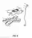 Fig. 09 - SET OF ADJUSTABLE JUGGLING MODULES INCLUDING A FACILITATING DETACHABLE OR FIXED FASTENING DEVICE AND AN INTEGRATED TRAINING SYSTEM