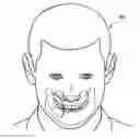 Fig. 01 - PROTECTIVE AND HEALING INNER CHEEK PADS