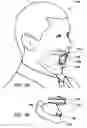 Fig. 04 - PROTECTIVE AND HEALING INNER CHEEK PADS