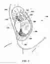 Fig. 05 - PROTECTIVE AND HEALING INNER CHEEK PADS