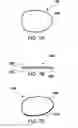 Fig. 08 - PROTECTIVE AND HEALING INNER CHEEK PADS