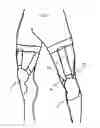 Fig. 08 - SHIN PROTECTION ELEMENT AND PROTECTION ASSEMBLY FOR CYCLISTS
