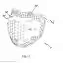 Fig. 15 - SHIN PROTECTION ELEMENT AND PROTECTION ASSEMBLY FOR CYCLISTS