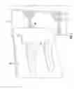 Fig. 06 - Pocket hole jig