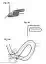 Fig. 03 - Process of treating a workpiece using a liquid jet guided laser beam